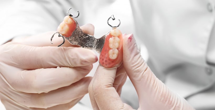 5 teeth in tinfoil-like connector