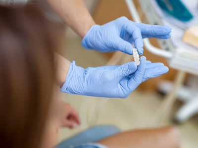 Dental Bridges