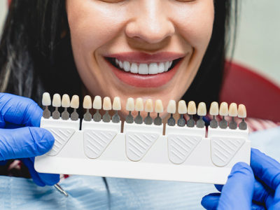 Transform Your Smile: Discover Cosmetic Dentistry Veneers!