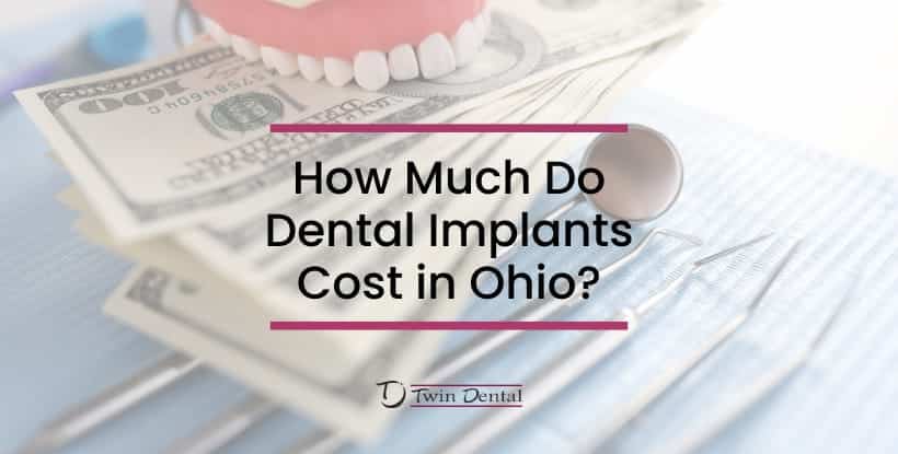 how much do dental implants cost?
