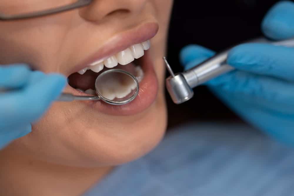 dentist looking at patients teeth with magnifying glass