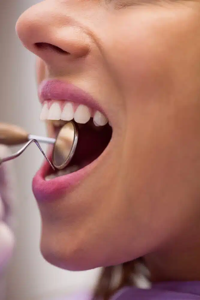 patient having her teeth looked at up close