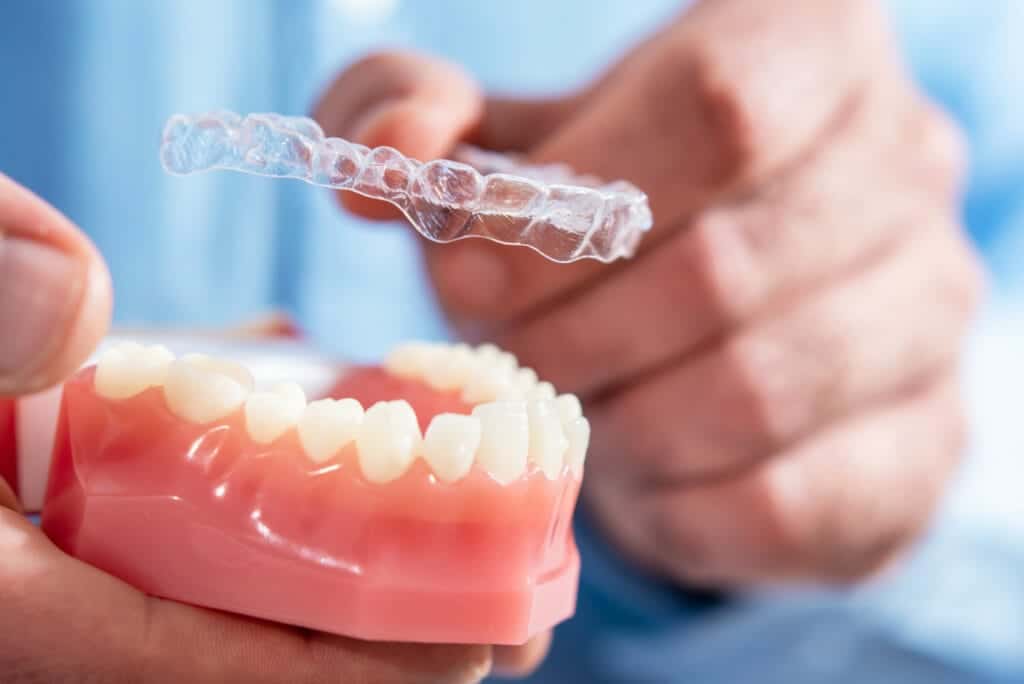 Invisible and removable aligners for teeth alignment