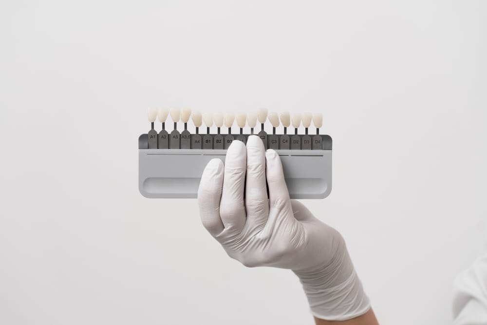 selection set of dental veneers