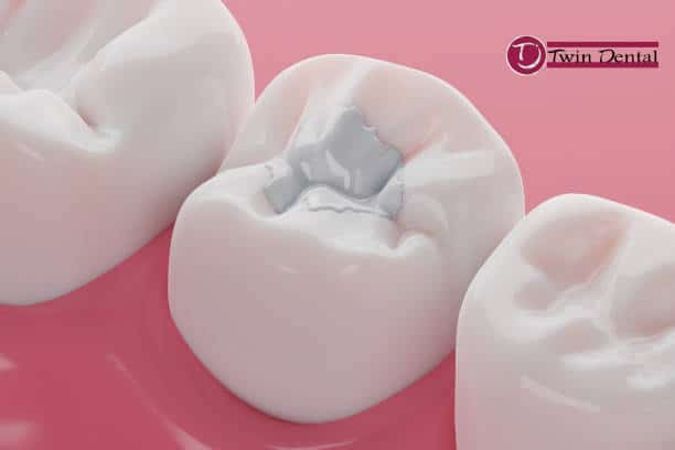 3D graphic dental sealant