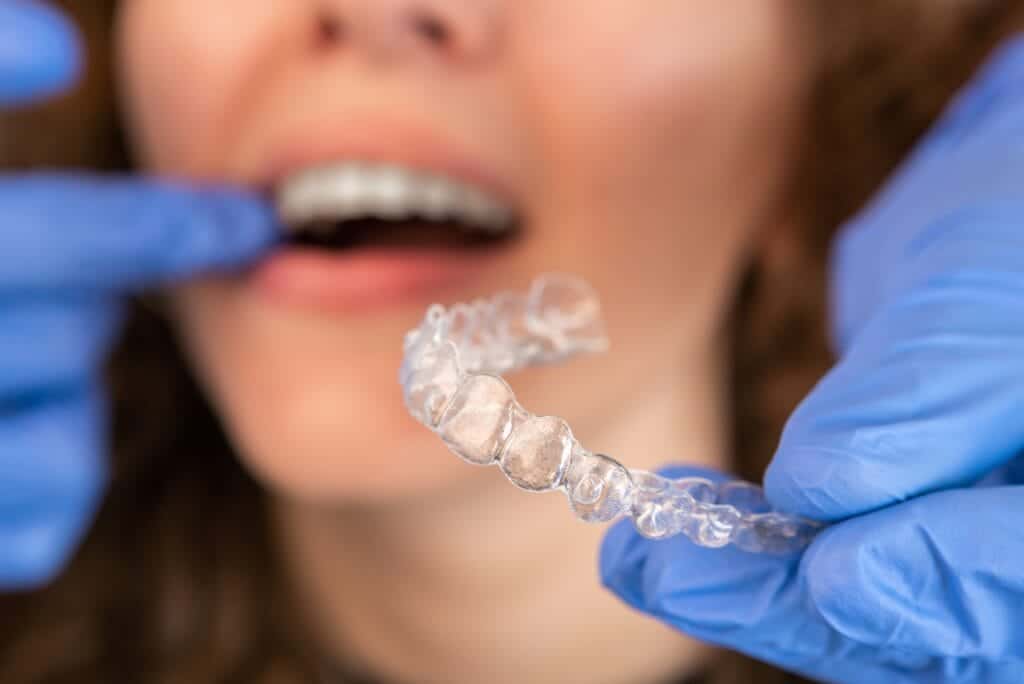 Close-up of Invisalign aligners with a dentist and woman blurred in the background during consultation